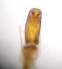 Rhizophagus sp.